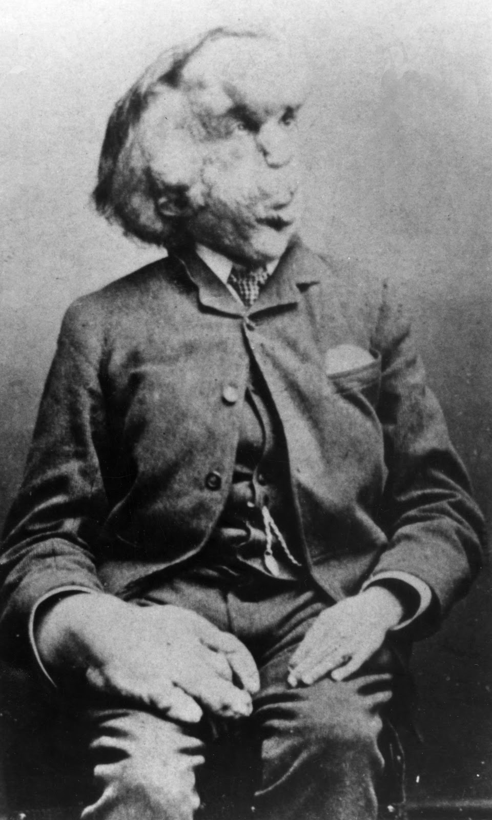 The Elephant Man official poster